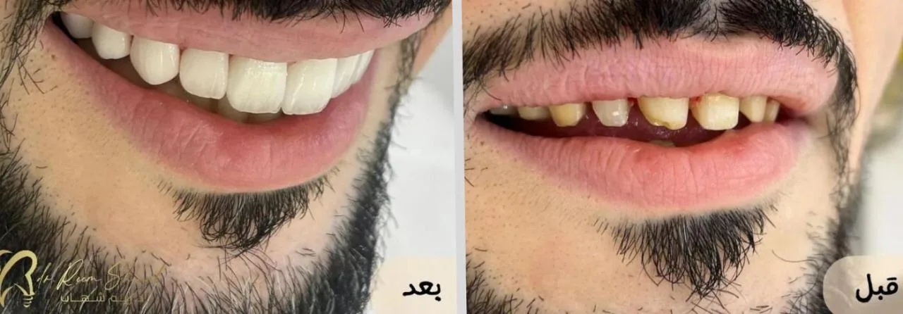 عيادات دكتورة/ ريم شهاب - صفوة المهيدب للأسنان - القنفذة شكر خاص لصانع الابتسامة الدكتور / محمود حجاج