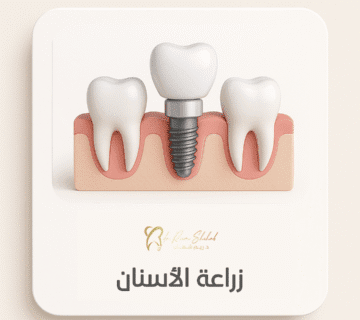 خدمات موقع عيادة الاسنان 02 360x320