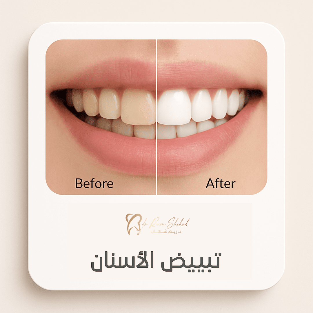 خدمات موقع عيادة الاسنان 05