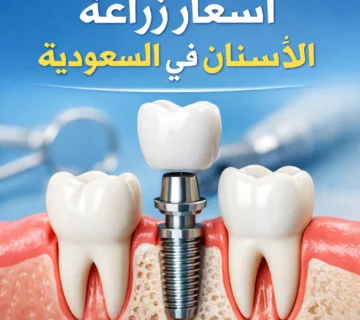 أسعار زراعة الأسنان في القنفدة السعودية