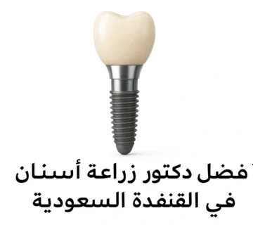 أفضل دكتور زراعة أسنان